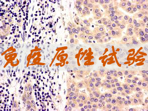 亿万先生mr免疫原性试验效劳