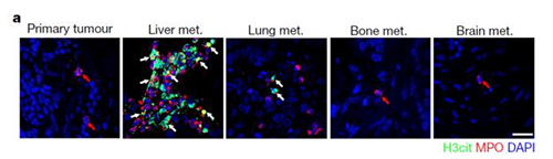 转入小鼠模子获得相同的试验效果，，，，，，且在转移爆发前NET已在肝脏聚积。。。。。。