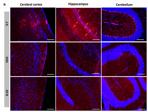 被包裹在含有NT-类脂质的LNP中的Cre重组酶乐成转移。。。。。。大脑中的转染神经元呈红色高亮。。。。。。