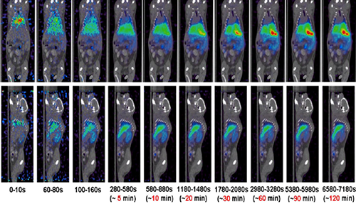 亿万先生mrPET/CT分子影像手艺平台