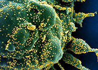 唾液检测新冠抗体新要领来了，，，，，，，，获取效果仅需几小时！