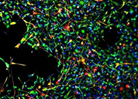 天下首创：药物将干细胞指导至受损部位，，，，，，提高其愈合能力！