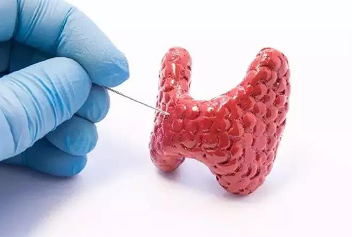 甲状腺疾病！！。。。。。，，，，，包括甲状腺功效减退和甲状腺功效亢进，，，，，，，自古以来就是重复被医学研究职员研究的疾病