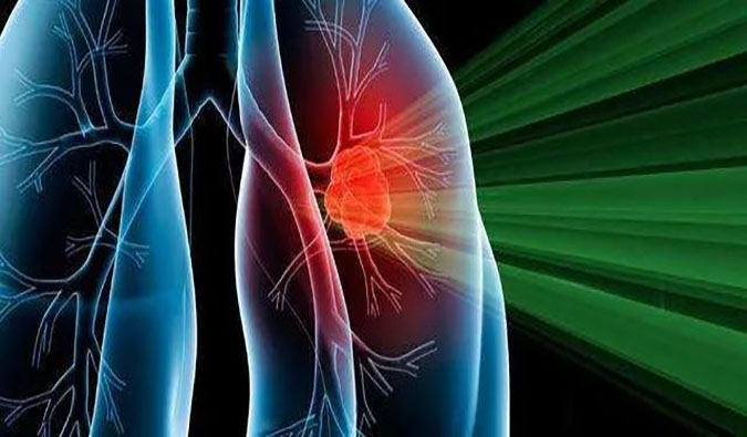 盛世泰科1类立异药物CGT-9475实现中美双报双批 | 亿万先生mr一站式临床宿世物医药研发效劳平台助力